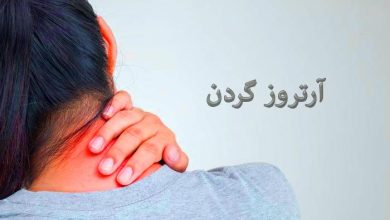 آرتروز گردن و علائم آن چیست ؟
