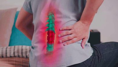 درمان دیسک کمر