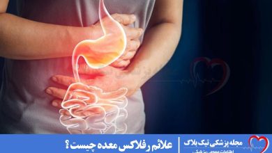 علائم رفلاکس معده چیست ؟