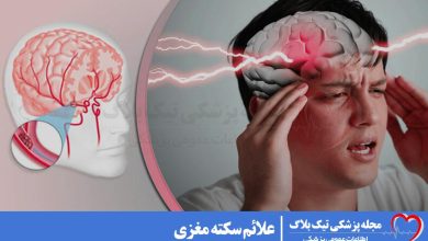 علائم سکته مغزی