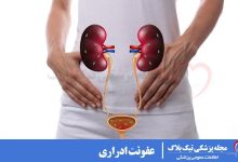 عفونت ادراری