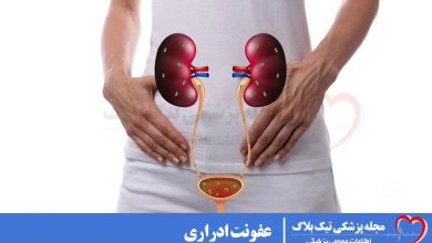 عفونت ادراری