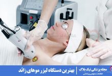 بهترین دستگاه لیزر موهای زائد