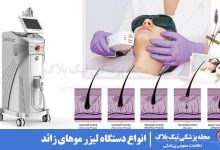 دستگاه لیزر موهای زائد