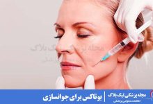 بوتاکس برای جوانسازی