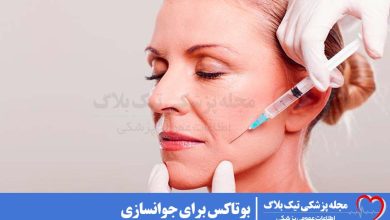 بوتاکس برای جوانسازی